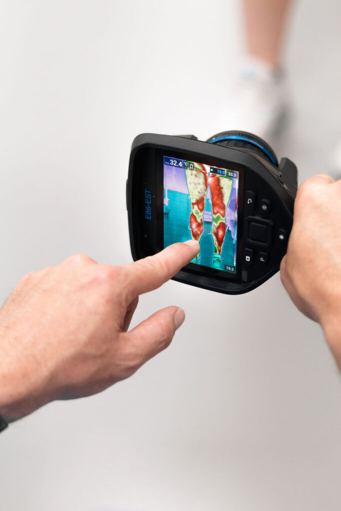blessurepreventie - thermografie met Thermo Human